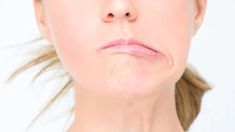 Các bài thuốc dân gian chữa méo miệng hiệu quả