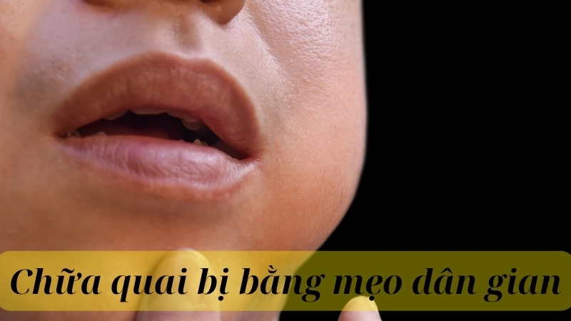 Tổng hợp các cách chữa quai bị dân gian hiệu quả