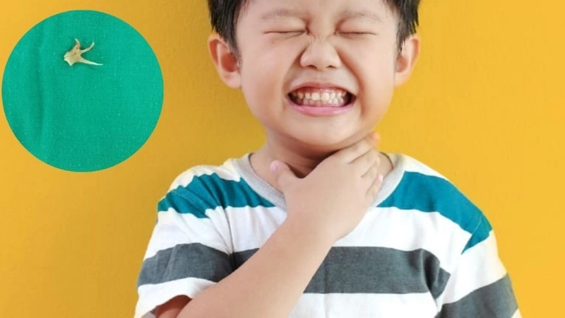 Bị hóc xương cá có nguy hiểm không?