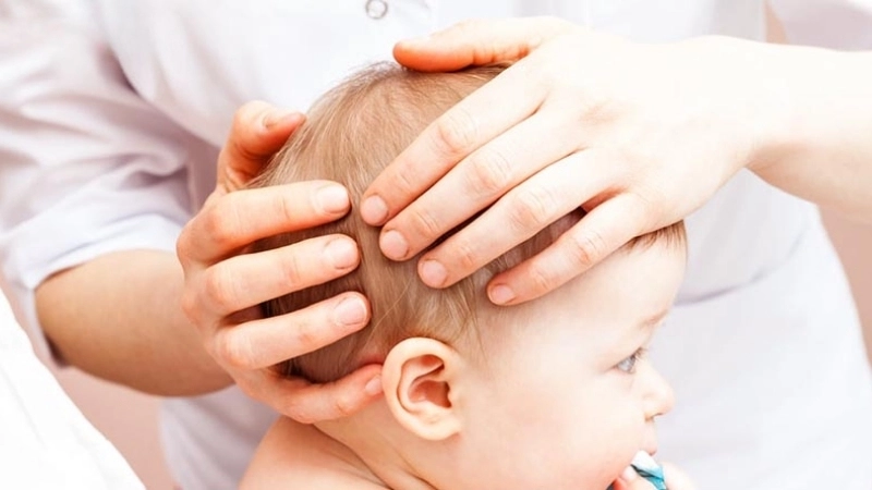 Những lưu ý quan trọng khi chữa méo đầu ở trẻ sơ sinh