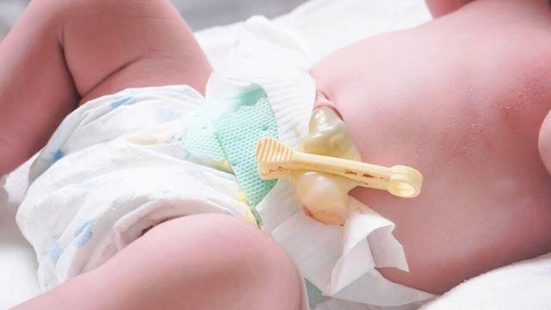 Cách chăm sóc rốn trẻ sơ sinh sau khi rụng
