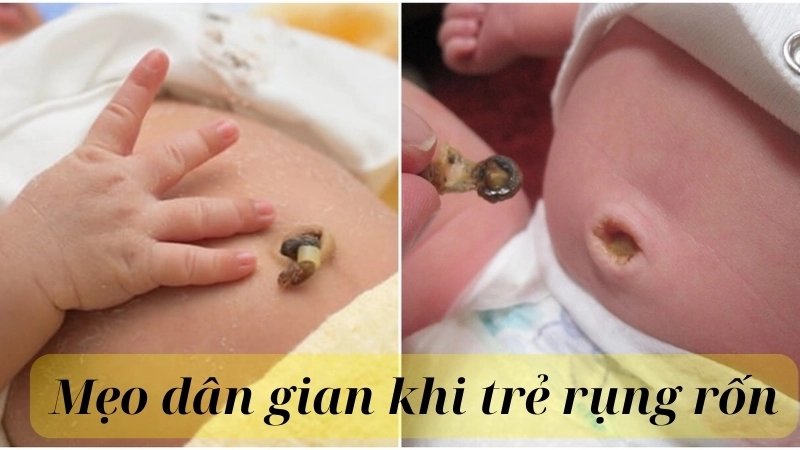 Những mẹo dân gian khi trẻ rụng rốn