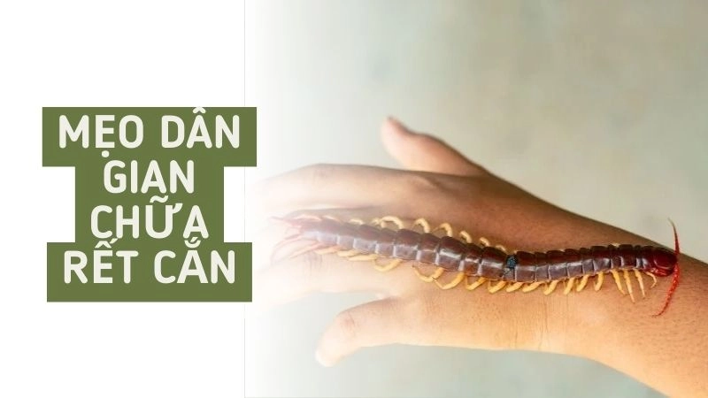Vì sao rết cắn lại nguy hiểm và cần xử lý ngay?