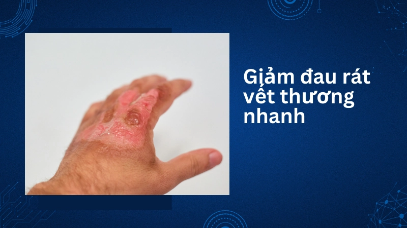 Mẹo làm mát vết thương giúp giảm đau rát cực nhanh