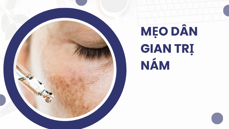 Mẹo dân gian trị nám được nhiều người áp dụng