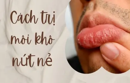 Cách trị môi khô nứt nẻ dứt điểm không cần son dưỡng