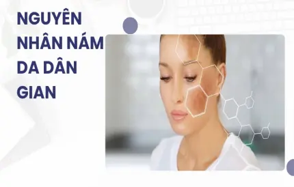 Bí quyết trị nám tại nhà hiệu quả từ mẹo dân gian truyền thống