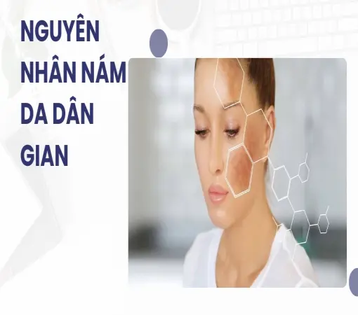 Bí quyết trị nám tại nhà hiệu quả từ mẹo dân gian truyền thống