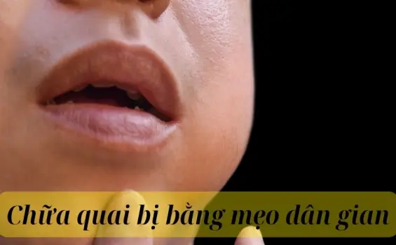 Những cách chữa quai bị bằng mẹo dân gian được áp dụng nhiều