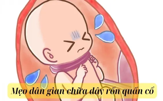 Mẹo dân gian chữa dây rốn quấn cổ giúp mẹ bầu an tâm sinh nở