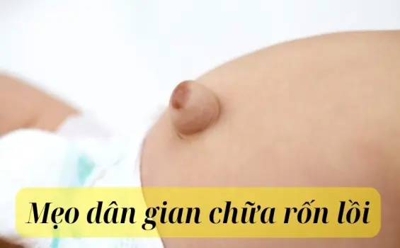 Mẹo dân gian chữa rốn lồi được nhiều mẹ bỉm tin dùng
