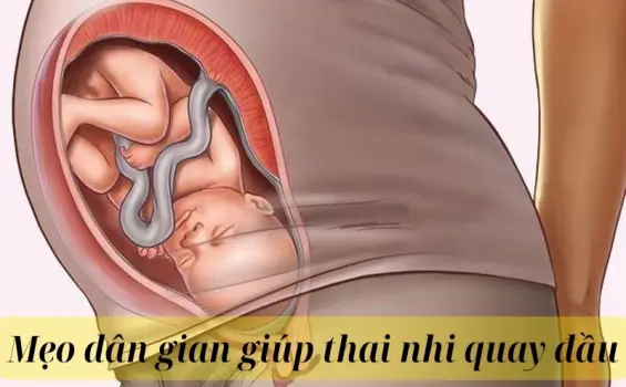 Mẹo dân gian giúp thai nhi quay đầu dễ sinh thường hơn