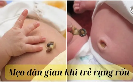 Những mẹo dân gian khi trẻ rụng rốn an toàn và nhanh khô rốn
