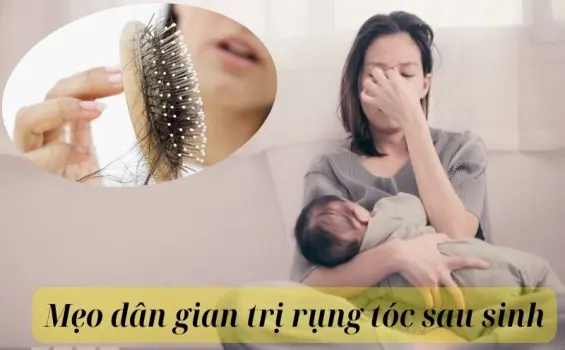 Mẹo dân gian trị rụng tóc sau sinh từ thảo dược quen thuộc