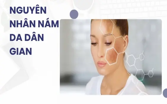 Bí quyết trị nám tại nhà hiệu quả từ mẹo dân gian truyền thống