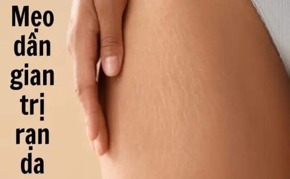 Mẹo dân gian trị rạn da cải thiện rõ chỉ sau 2 tuần