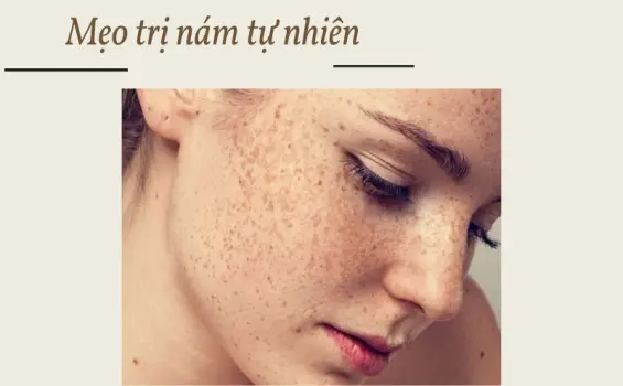 Mẹo trị nám tàn nhang tại nhà cho làn da trắng mịn không tì vết