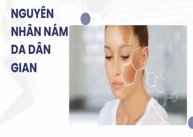 Bí quyết trị nám tại nhà hiệu quả từ mẹo dân gian truyền thống