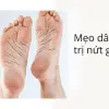 Cách trị nứt nẻ gót chân tại nhà: Mẹo dân gian giúp gót hồng