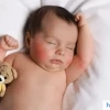 Mẹo Dân Gian Chữa Chàm Sữa Cho Trẻ Sơ Sinh: An Toàn và Hiệu Quả