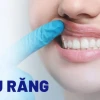 Nướu răng là gì? Cấu tạo, chức năng và các vấn đề sức khỏe