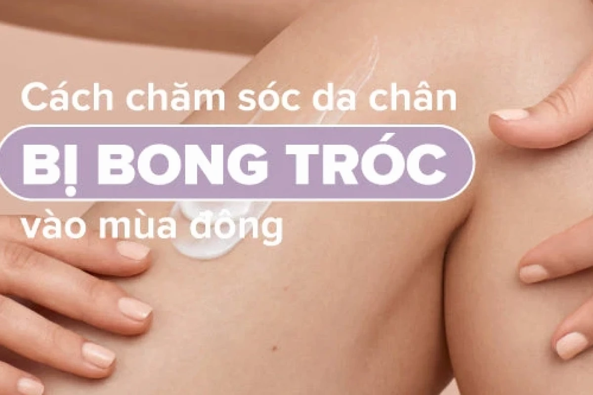 12 Mẹo Chữa Bong Da Chân Tại Nhà Đơn Giản, Hiệu Quả