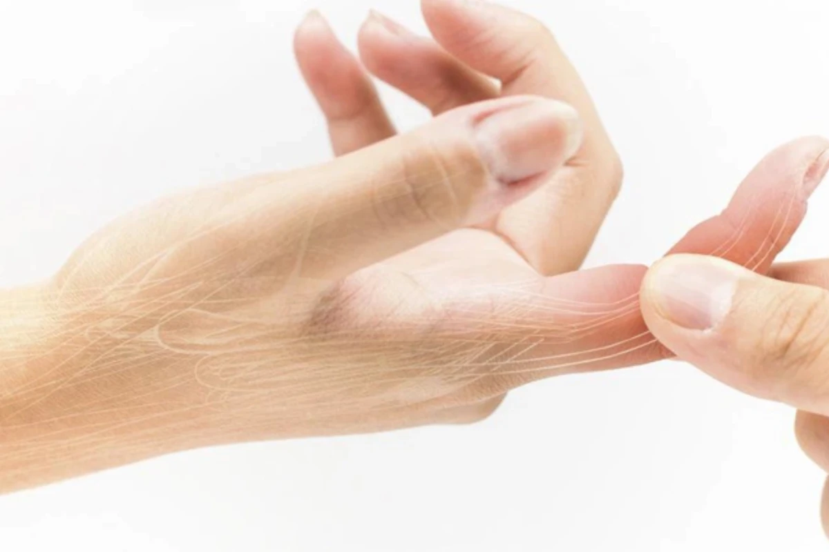 Mẹo Chữa Bong Gân Ngón Tay Cái: Hướng Dẫn Chi Tiết