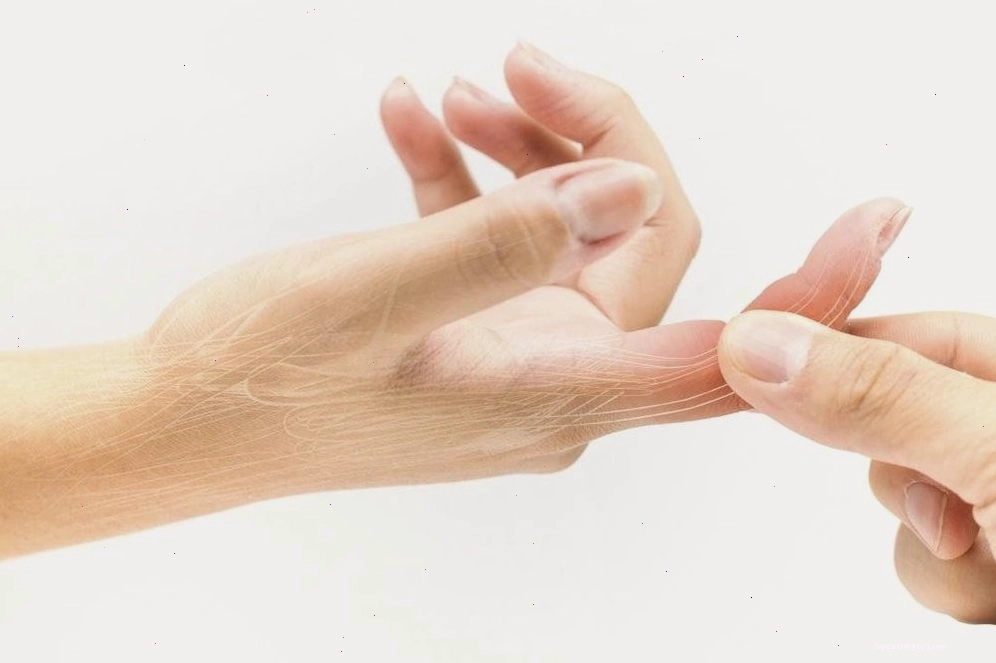 Bong gân ngón tay gây khó khăn trong việc vận động