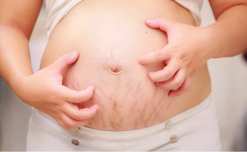Các loại lá tắm phổ biến trị ngứa