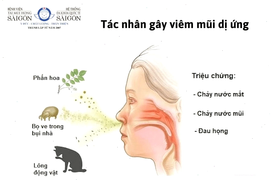 Các tác nhân gây viêm mũi dị ứng thường gặp
