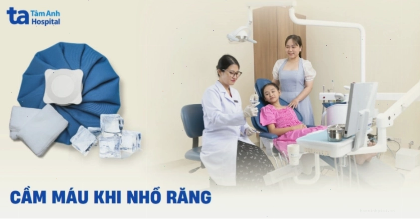 Cách cầm máu sau khi nhổ răng hiệu quả tại nhà