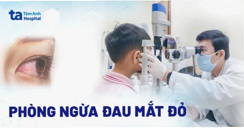 Cách phòng ngừa đau mắt đỏ hiệu quả