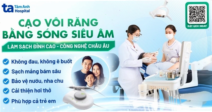 Dịch vụ cạo vôi răng