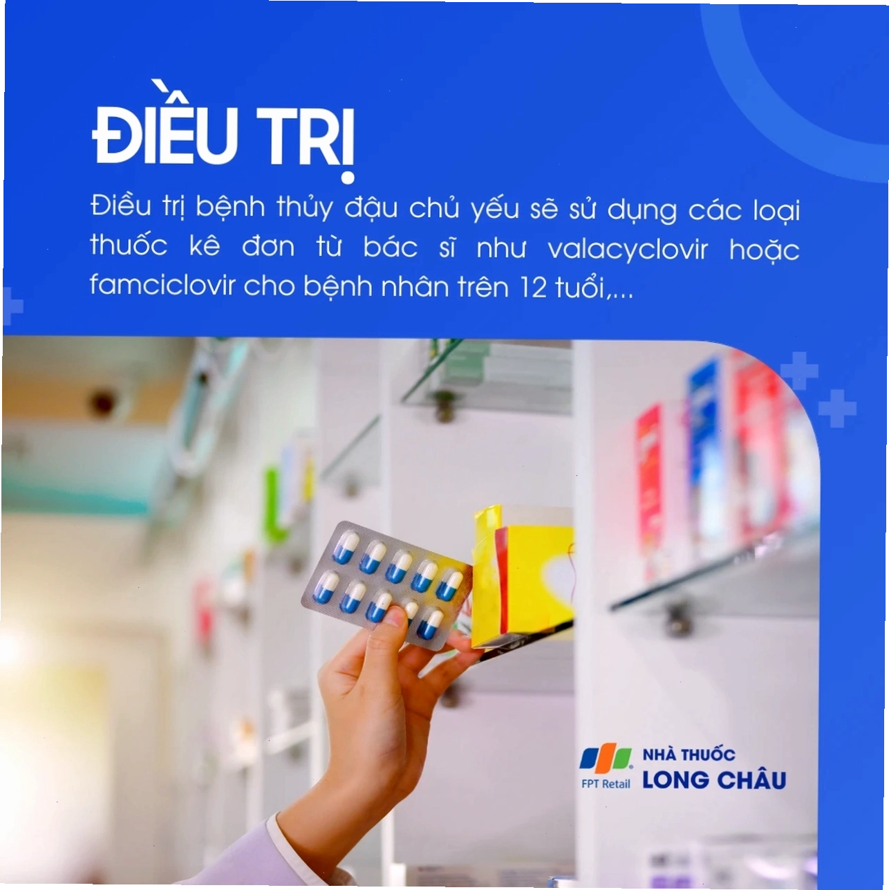 Điều trị varicella bằng thuốc kháng virus và các biện pháp chăm sóc giảm ngứa