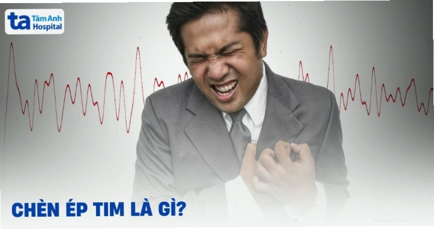 Hình ảnh minh họa tình trạng chèn ép tim ảnh hưởng đến hoạt động của tim