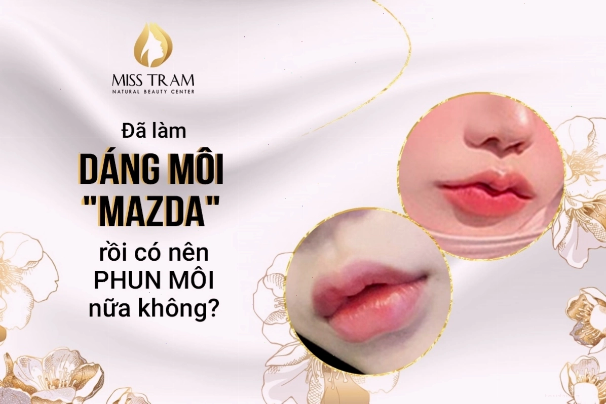 Kết quả phun môi thẩm mỹ theo xu hướng môi Mazda