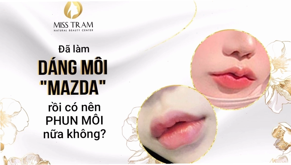 Kỹ thuật phun môi thẩm mỹ tạo dáng môi Mazda tự nhiên