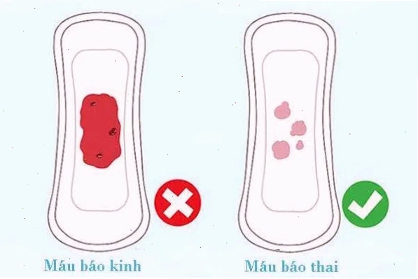 Máu báo thai là một trong những dấu hiệu sớm của thai kỳ