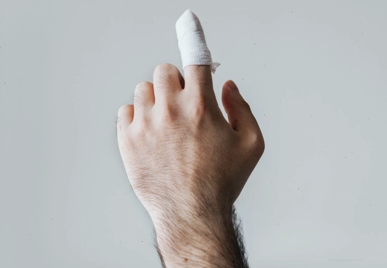 Ngón tay bị bong gân cần được băng quấn cố định