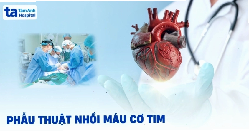 Phẫu thuật nhồi máu cơ tim là một trong những can thiệp cần thiết cho bệnh nhân tim mạch