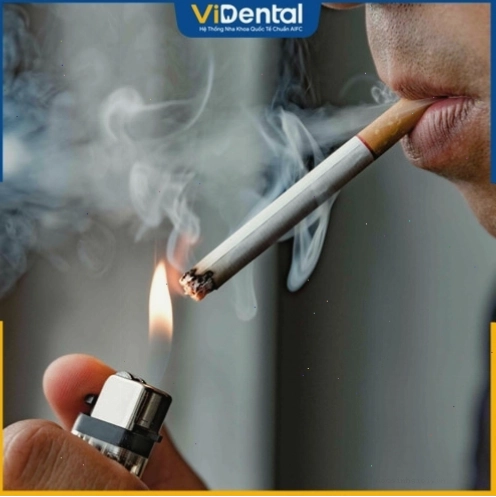 Răng dễ xỉn màu do hút thuốc lá và các yếu tố bên ngoài khác