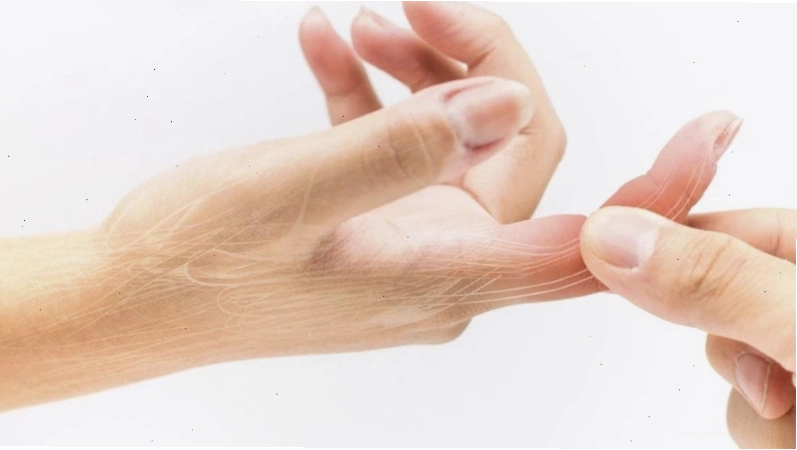 Sưng đỏ và hạn chế vận động là biểu hiện của bong gân ngón tay