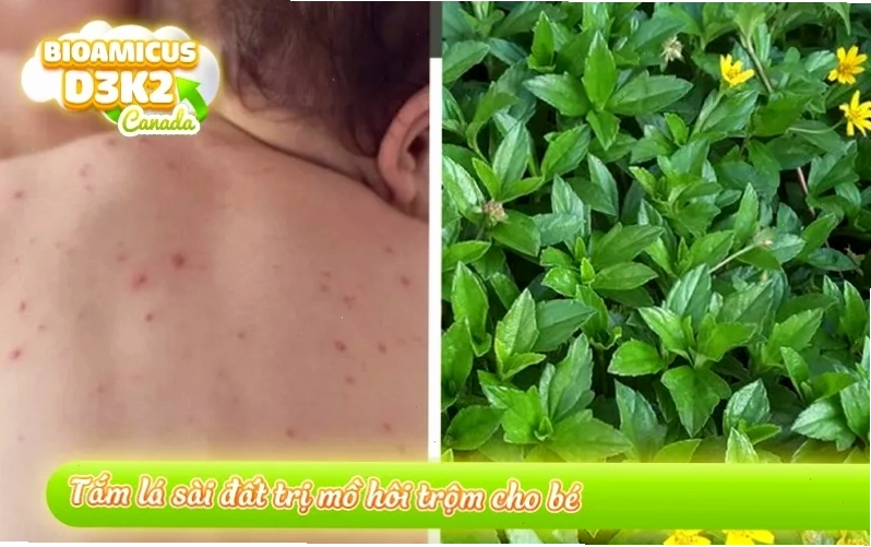Tắm lá sài đất giúp trị rôm sẩy