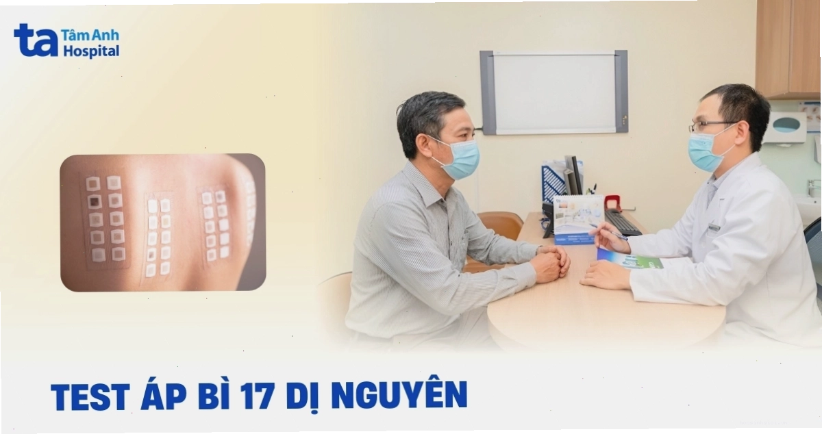 Test áp bì giúp chẩn đoán dị nguyên gây dị ứng