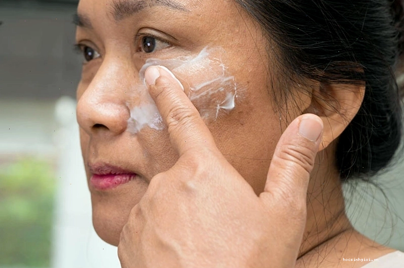 Thoa kem là một cách trị nám chân sâu phổ biến