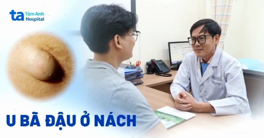 U bã đậu ở nách: Nguyên nhân, hình ảnh, điều trị, phòng ngừa