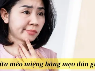 Tổng hợp cách chữa méo miệng bằng mẹo dân gian hiệu quả