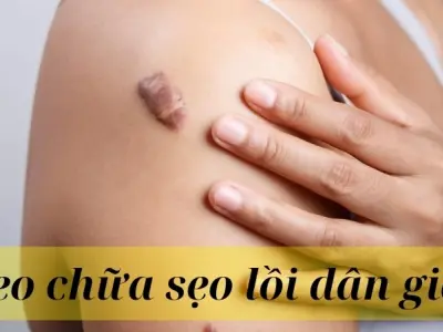 Tổng hợp mẹo chữa sẹo lồi dân gian lành tính cho mọi loại da