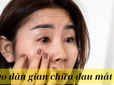 Lưu ngay các mẹo dân gian chữa đau mắt đỏ cực kỳ hiệu nghiệm