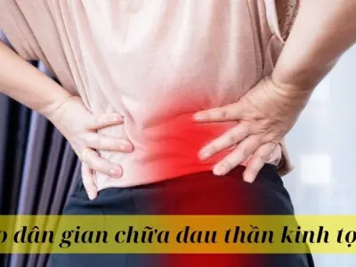 Bật mí mẹo dân gian chữa đau thần kinh tọa cực hiệu quả